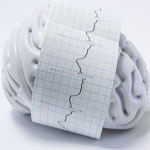 Unfall mit Bewusstseinsstörung